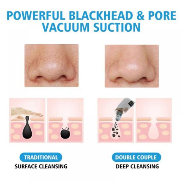 Electric Suction Blackhead Instrument Home Beauty Instrument Blackhead Pore Cleaning